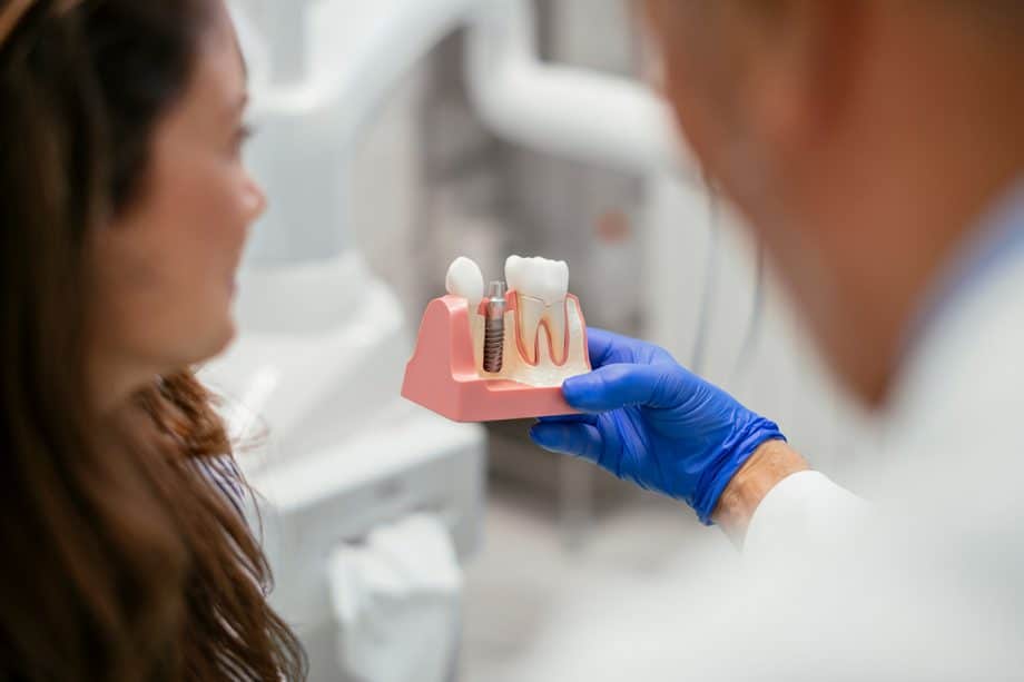 How To Clean Dental Implants