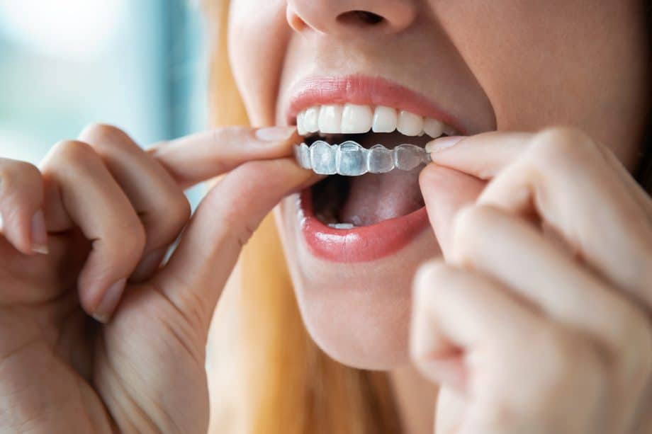 What Makes Someone a Good Candidate for Invisalign?
